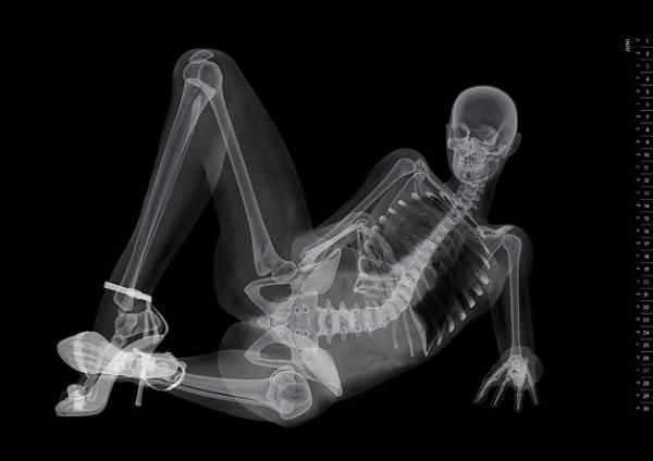 X Ray Pin Up Calendar