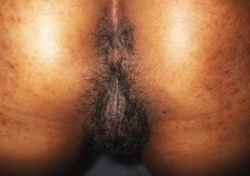 Black Malaysian Women