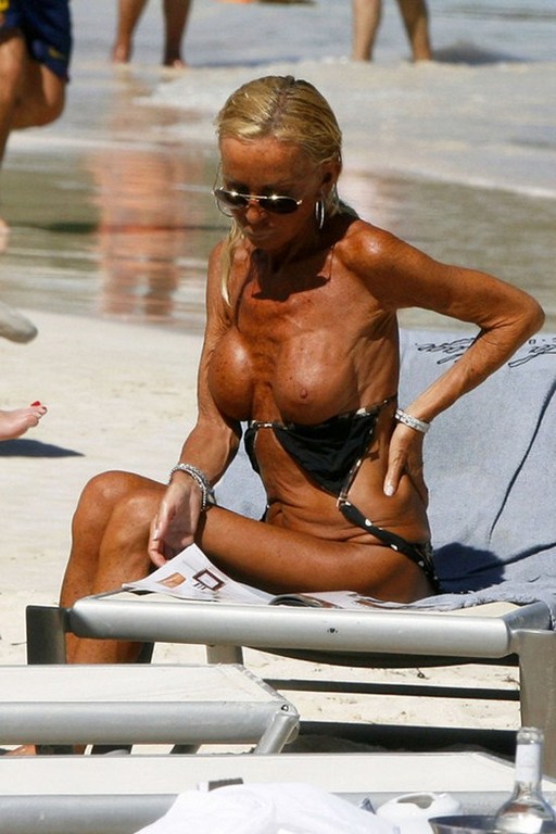 Donatella Versace Breast Implants