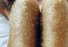Hairy Leg Black Women