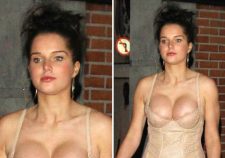 Helen Flanagan Boob Job