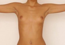 Nude Amateur Model Galleries