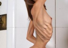 Pro Ana Girls Nude