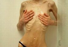 Super Skinny Waifs Bony Thin Slender Stick