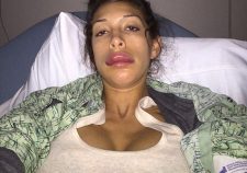 Teen Mom Farrah Lips Botched