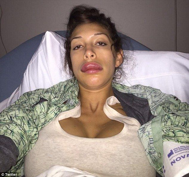 Teen Mom Farrah Lips Botched