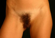 Untrimmed Female Pubic Hair