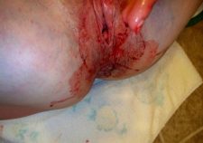 Virgin Pussy Bleeding On Period