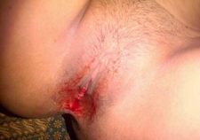 Virgin Pussy Porn