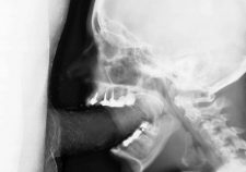 X Ray Cock